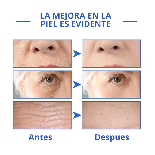 REJUVE21™ - SUERO ANTIARRUGAS , reafirma y transforma tu piel en 21 días