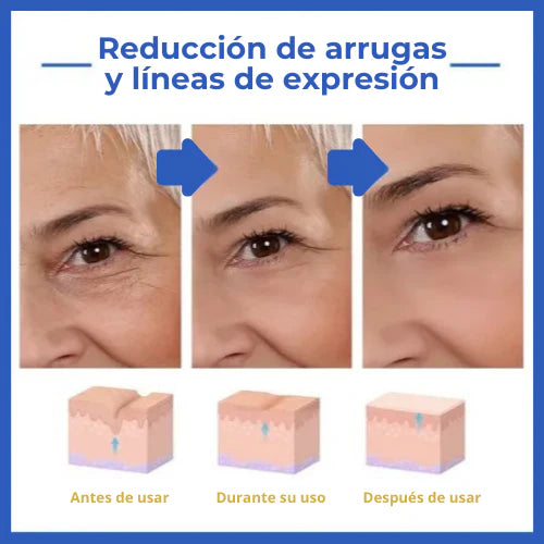 REJUVE21™ - SUERO ANTIARRUGAS , reafirma y transforma tu piel en 21 días